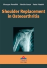 Image for Shoulder Replacement in Osteoarthritis