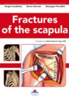 Image for Fractures of the Scapula