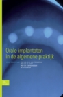 Image for Orale implantaten in de algemene praktijk