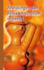 Image for Afwijkingen aan penis en scrotum in beeld