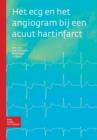 Image for Het ECG En Het Angiogram Bij Een Acuut Hartinfarct