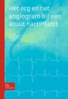 Image for Het ecg en het angiogram bij een acuut hartinfarct