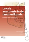 Image for Lokale anesthesie in de tandheelkunde