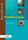 Image for Handboek prostaatcarcinoom