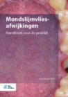 Image for Mondslijmvliesafwijkingen: Handboek Voor De Praktijk
