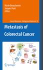 Image for Metastasis of colorectal cancer : 14