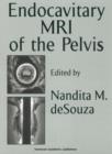 Image for Endocavitary MRI of the pelvis