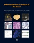Image for WHO Classification of Tumours of the Breast