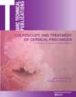 Image for Colposcopy and treatment of cervical precancer
