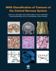 Image for WHO classification of tumours of the central nervous system
