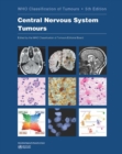Image for WHO classification of tumours of the central nervous system