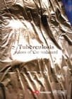 Image for Tuberculosis : Voices of the Unheard