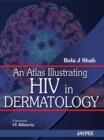 Image for An Atlas Illustrating HIV in Dermatology