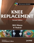 Image for Knee Replacement