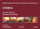 Image for Single Surgical Procedures in Obstetrics and Gynaecology - Volume 14 - Uterus : A Colour Atlas of Caesarean Section