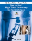 Image for Step by Step: High Tibial Osteotomy by Hemicallotasis