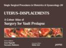 Image for Single Surgical Procedures in Obstetrics and Gynaecology - Volume 20 - UTERUS - DISPLACEMENTS