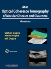 Image for Atlas Optical Coherence Tomography of Macular Diseases and Glaucoma