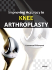 Image for Improving Accuracy in Knee Arthroplasty