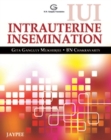 Image for IUI Intrauterine Insemination