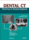 Image for Dental CT Third Eye in Dental Implants