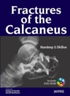 Image for Fractures of the Calcaneus