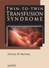 Image for Twin-to-Twin Transfusion Syndrome