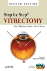 Image for Step by Step: Vitrectomy