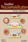 Image for Simplified Phacoemulsification