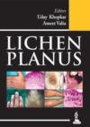 Image for Lichen Planus