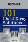 Image for 101 Chest X-Ray Solutions