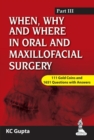 Image for When, Why and Where in Oral and Maxillofacial Surgery: Prep Manual for Undergraduates and Postgraduates Part-III