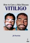 Image for How to cure a skin disease  : vitiligo
