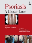 Image for Psoriasis