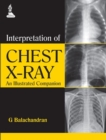 Image for Interpretation of chest x-ray  : an illustrated companion