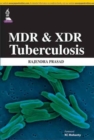 Image for MDR and XDR Tuberculosis