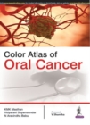 Image for Color Atlas of Oral Cancer