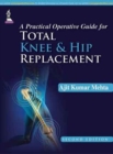 Image for A practical operative guide for total knee and hip replacement