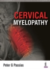 Image for Cervical Myelopathy