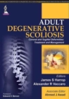 Image for Adult Degenerative Scoliosis