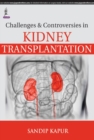 Image for Challenges and Controversies in Kidney Transplantation