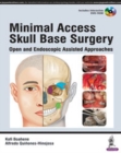 Image for Minimal Access Skull Base Surgery