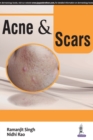 Image for Acne &amp; scars