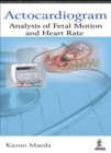 Image for Actocardiogram  : analysis of fetal motion and heart rate
