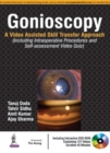 Image for Gonioscopy : A Video Assisted Skill Transfer Approach