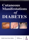 Image for Cutaneous Manifestations of Diabetes