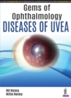 Image for Diseases of uvea