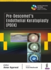 Image for Pre-Descemet’s Endothelial Keratoplasty (PDEK)