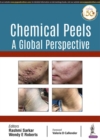 Image for Chemical peels  : a global perspective