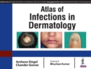 Image for Atlas of Infections in Dermatology